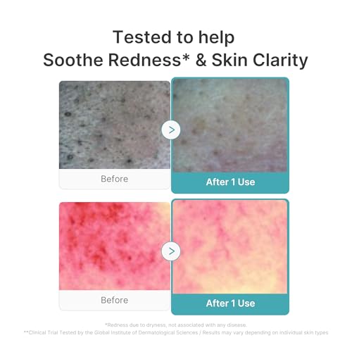 medicube Facial Cleanser Azelaic Acid Whip Cleanser