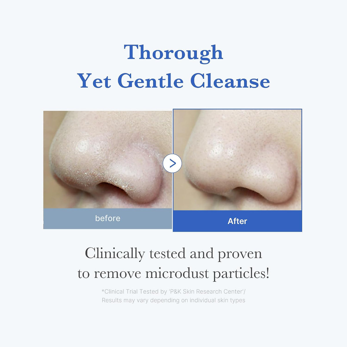 medicube Facial Cleanser Azelaic Acid Whip Cleanser