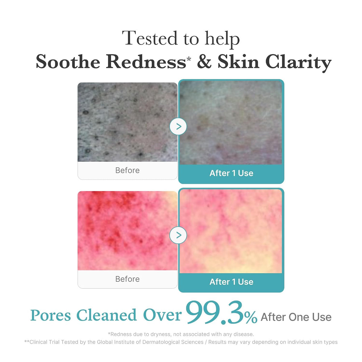 medicube Facial Cleanser Azelaic Acid Whip Cleanser