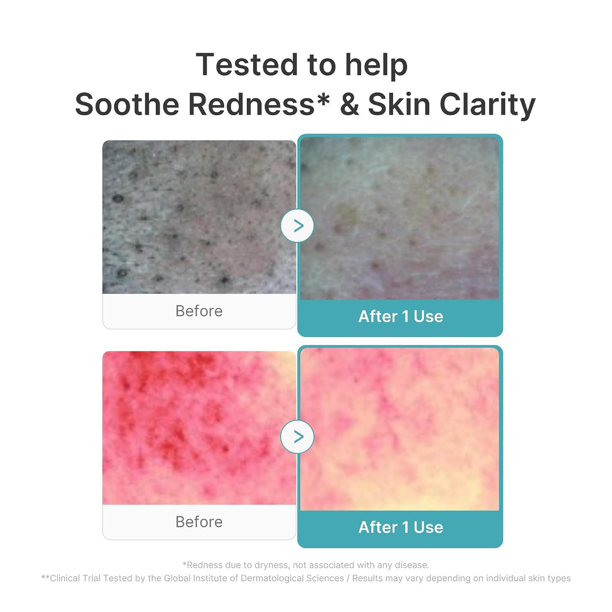 medicube Facial Cleanser Azelaic Acid Whip Cleanser