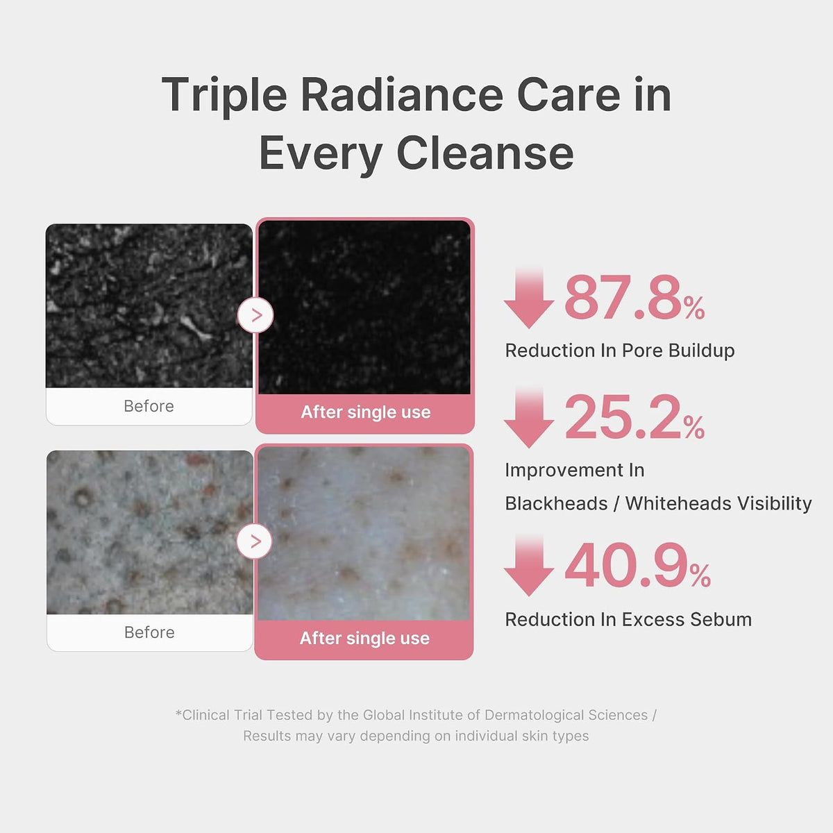 medicube Facial Cleanser Azelaic Acid Whip Cleanser